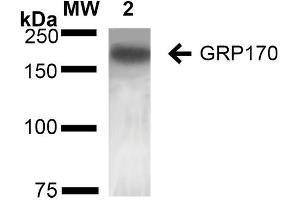 Western Blot analysis of Rat Liver showing detection of ~170 kDa GRP170 protein using Mouse Anti-GRP170 Monoclonal Antibody, Clone 6E3-2C3 (ABIN2868628).