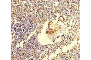 Immunohistochemistry of paraffin-embedded human spleen tissue using ABIN7171802 at dilution of 1:100 (TSBP1 (AA 239-476) antibody)