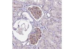 Immunohistochemical staining of human kidney with UBXN2B polyclonal antibody  shows distinct cytoplasmic positivity in glomerular cells.