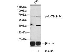 Western blot analysis of extracts of 293 cells, using Phospho--S474 antibody (ABIN3023507, ABIN3023508, ABIN3023509 and ABIN6225357) 1:1000 dilution. (AKT2 antibody  (pSer474))