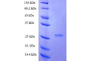 SDS-PAGE (SDS) image for Interferon epsilon (IFNE) (AA 22-208) protein (His tag) (ABIN5711495)