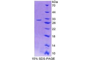 Image no. 1 for Microtubule-Associated Protein 4 (MAP4) (AA 2-250) protein (His tag) (ABIN4988667) (MAP4 Protein (AA 2-250) (His tag))
