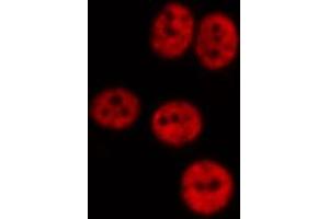ABIN6267012 staining Hela by IF/ICC. (CTBP1 antibody  (Internal Region))