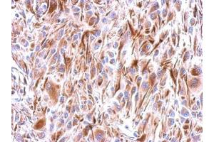 IHC-P Image Immunohistochemical analysis of paraffin-embedded U374 xenograft, using Frizzled 9, antibody at 1:500 dilution. (FZD9 antibody  (N-Term))