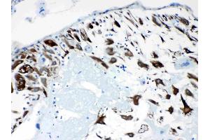 IHC analysis of CPI17 alpha using anti- CPI17 alpha antibody . (CPI-17 antibody  (AA 30-126))
