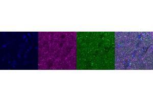 Immunohistochemistry (IHC) image for anti-Cannabinoid Receptor 1 (CNR1) antibody (ABIN7456057) (CNR1 antibody)