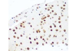 Immunohistochemistry of paraffin-embedded Mouse brain using Argonaute-2 Polyclonal Antibody at dilution of 1:100 (40x lens).