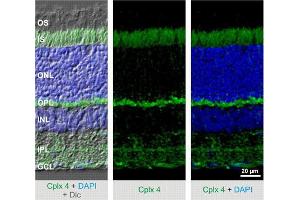 Indirect immunostaining of mouse retina (dilution 1 : 2000).