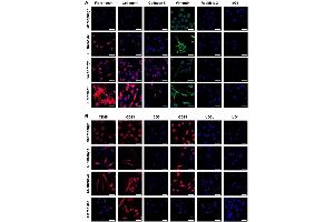 Immunostaining (ISt) image for anti-COL1A2/COL1A1 antibody (ABIN5596819)
