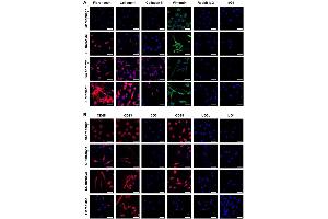 Immunostaining (ISt) image for anti-Collagen, Type I (COL1) antibody (ABIN5596819)