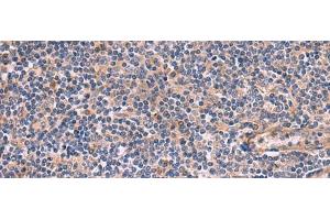 Immunohistochemistry of paraffin-embedded Human tonsil tissue using ARIH2 Polyclonal Antibody at dilution of 1:80(x200)