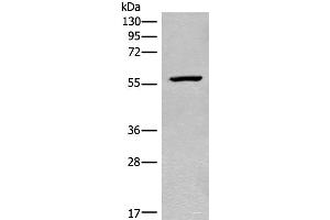 Western blot analysis of Mouse heart tissue lysate using CDADC1 Polyclonal Antibody at dilution of 1:450 (CDADC1 antibody)