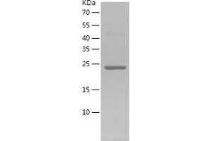 Western Blotting (WB) image for Superoxide Dismutase 2, Mitochondrial (SOD2) (AA 1-222) protein (His tag) (ABIN7285212) (SOD2 Protein (AA 1-222) (His tag))