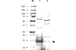 Image no. 1 for anti-Ubiquitin-Conjugating Enzyme E2N (UBE2N) (AA 40-51) antibody (ABIN401175)