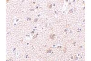 Immunohistochemistry of ARMET in human brain tissue with ARMET polyclonal antibody  at 2. (MANF antibody  (N-Term))