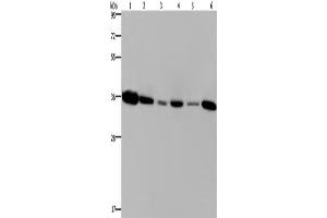 Western Blotting (WB) image for anti-Emerin (EMD) antibody (ABIN2423376) (Emerin antibody)