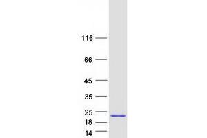 Western Blotting (WB) image for High Mobility Group AT-Hook 1 (HMGA1) (Transcript Variant 1) protein (Myc-DYKDDDDK Tag) (ABIN2722867)