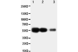 Anti-RAGE antibody, Western blotting Lane 1: Recombinant Human RAGE Protein 10ng Lane 2: Recombinant Human RAGE Protein 5ng Lane 3: Recombinant Human RAGE Protein 2. (RAGE antibody  (Middle Region))