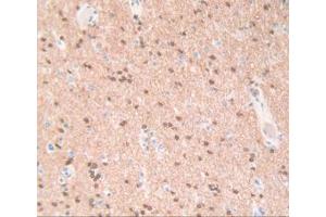 IHC-P analysis of Human Brain Tissue, with DAB staining. (QDPR antibody  (AA 1-244))