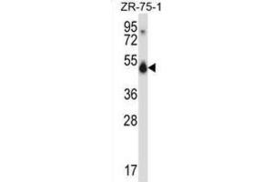 Western Blotting (WB) image for anti-CUGBP, Elav-Like Family Member 1 (CELF1) antibody (ABIN2997688) (CELF1 antibody)