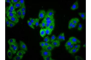 Immunofluorescence staining of HepG2 cells with ABIN7159352 at 1:133, counter-stained with DAPI. (MAGI1 antibody  (AA 1234-1367))