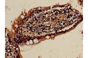 Immunocytochemistry analysis of human small intestine tissue using ABIN7152509 at dilution of 1:100 (FBXW7 antibody  (AA 1-707))