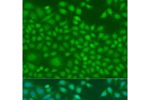 Immunofluorescence analysis of U2OS cells using NIN Polyclonal Antibody at dilution of 1:100. (Ninein antibody)