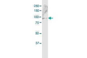 ABCB5 MaxPab polyclonal antibody. (ABCB5 antibody)