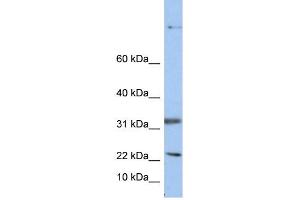 WB Suggested Anti-SEAntibody Titration:  0. (Sep 15 antibody  (Middle Region))