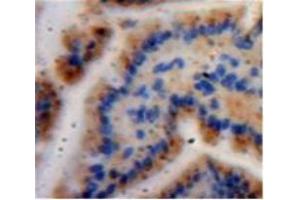 Used in DAB staining on fromalin fixed paraffin-embedded Bowels tissue (Caspase 6 antibody  (AA 194-293))