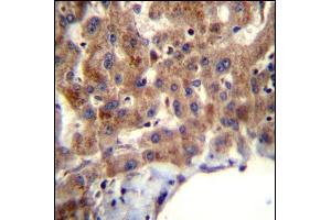 MBNL2 Antibody (C-term) (ABIN656947 and ABIN2846136) immunohistochemistry analysis in formalin fixed and paraffin embedded human liver tissue followed by peroxidase conjugation of the secondary antibody and DAB staining. (MBNL2 antibody  (C-Term))