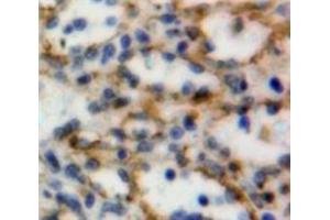 Used in DAB staining on fromalin fixed paraffin-embedded Spleen tissue (CD160 antibody  (AA 37-154))