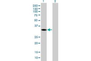 DHRS1 antibody  (AA 1-313)