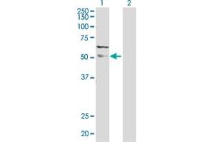 Western Blot analysis of MAPK9 expression in transfected 293T cell line by MAPK9 MaxPab polyclonal antibody. (JNK2 antibody  (AA 1-424))