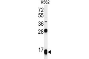 Western Blotting (WB) image for anti-Ribosomal Protein S15a (RA) antibody (ABIN3002138) (RPS15A antibody)