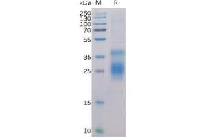Human HVEM Protein, His Tag on SDS-PAGE under reducing condition.