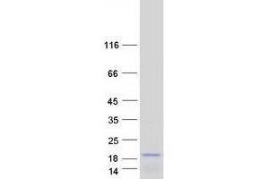 ASIP Protein (Myc-DYKDDDDK Tag)