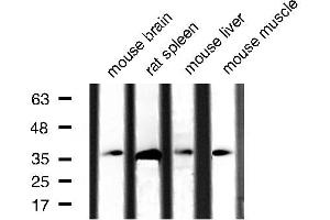 Western blot analysis of extracts of various tissue sample,using Caspase 3 Antibody . (Caspase 3 antibody  (Internal Region))