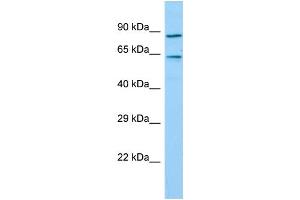 Host: Rabbit Target Name: TIGD7 Sample Type: Hela Whole Cell lysates Antibody Dilution: 1. (TIGD7 antibody  (C-Term))