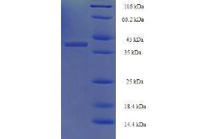 SDS-PAGE (SDS) image for VP4 (AA 247-479) protein (His-SUMO Tag) (ABIN5710776) (VP4 (AA 247-479) protein (His-SUMO Tag))