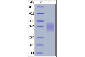 Human CD30 Ligand, His Tag, low endotoxin on  under reducing (R) condition. (TNFSF8 Protein (AA 63-234) (His tag))