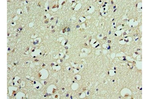 DEDD2 antibody  (AA 1-240)