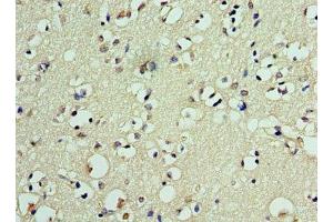 Immunohistochemistry of paraffin-embedded human brain tissue using ABIN7150359 at dilution of 1:100 (DEDD2 antibody  (AA 1-240))