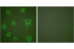 Immunofluorescence analysis of COS7 cells, using COL2 antibody (ABIN5976364). (COL2 antibody  (N-Term))