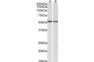 ABIN768572 (0. (CNR1 antibody  (N-Term))