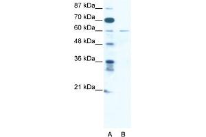 Western Blotting (WB) image for anti-Zinc Finger Protein 92 (ZNF92) (C-Term) antibody (ABIN2775107)