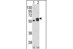 Western blot analysis of PDIA3 (arrow) using rabbit polyclonal PDIA3 Antibody (Center) (ABIN389465 and ABIN2839530). (PDIA3 antibody  (AA 192-220))