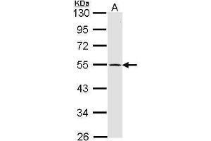 WB Image Sample (30 ug of whole cell lysate) A: IMR32 10% SDS PAGE antibody diluted at 1:1000 (Dopamine Receptor d1 antibody  (C-Term))