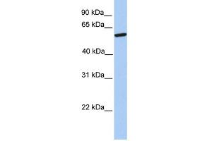 WB Suggested Anti-ZNF284 Antibody Titration:  0.