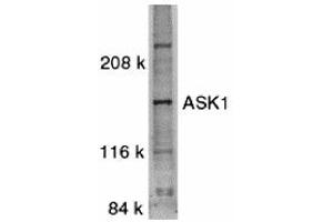 Western Blotting (WB) image for anti-Mitogen-Activated Protein Kinase Kinase Kinase 5 (MAP3K5) (C-Term) antibody (ABIN1030259) (ASK1 antibody  (C-Term))